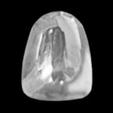 Lateral - iZi Tooth Jewellery